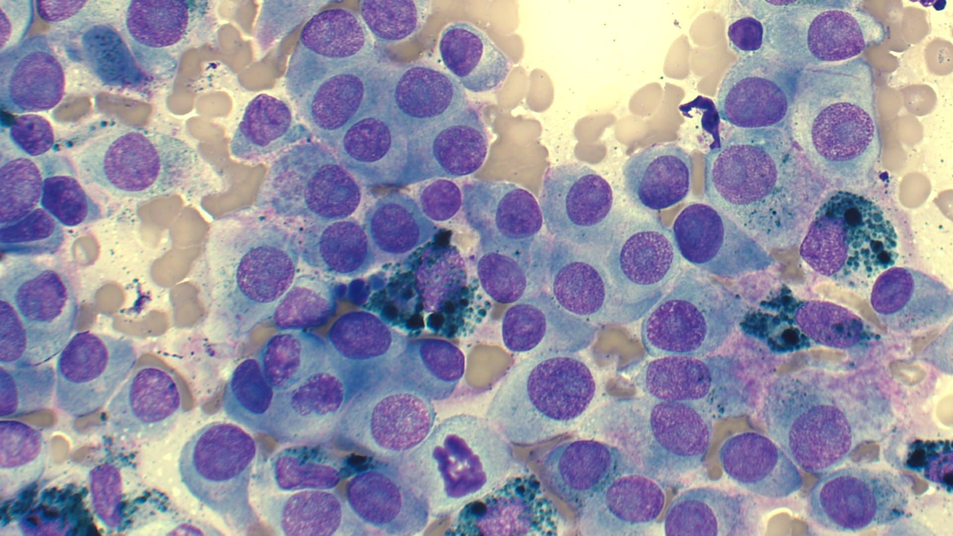 Melanocytes Cytology